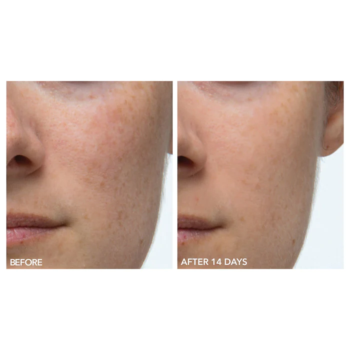 Mini Alpha Beta® Extra Strength Daily Peel